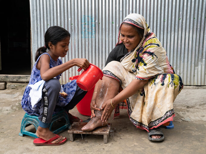 A woman with lymphedema washes her leg with the help of her daughter, this is part of her ongoing care. 