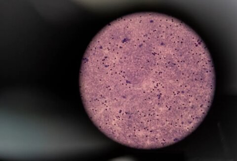 Lab technicians in Indonesia analyze night blood survey samples like this one, as seen in a microscope, to determine if lymphatic filariasis worms are present. Photo Credit: RTI International/Oscar Siagian