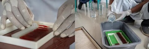 A lab technician prepares blood sample slides for processing and analysis. Slides are air dried for 24 hours and then soaked in water with a neutral pH for 20 to 30 minutes. Photo Credit: RTI International/Oscar Siagian