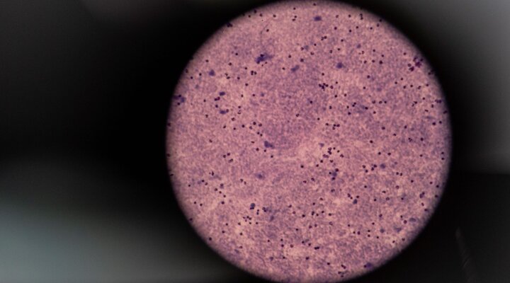 Lab technicians in Indonesia analyze night blood survey samples like this one, as seen in a microscope, to determine if lymphatic filariasis worms are present. Photo Credit: RTI International/Oscar Siagian